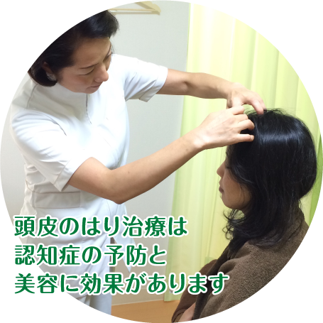 頭皮のはり治療は、認知症の予防と美容に効果があります